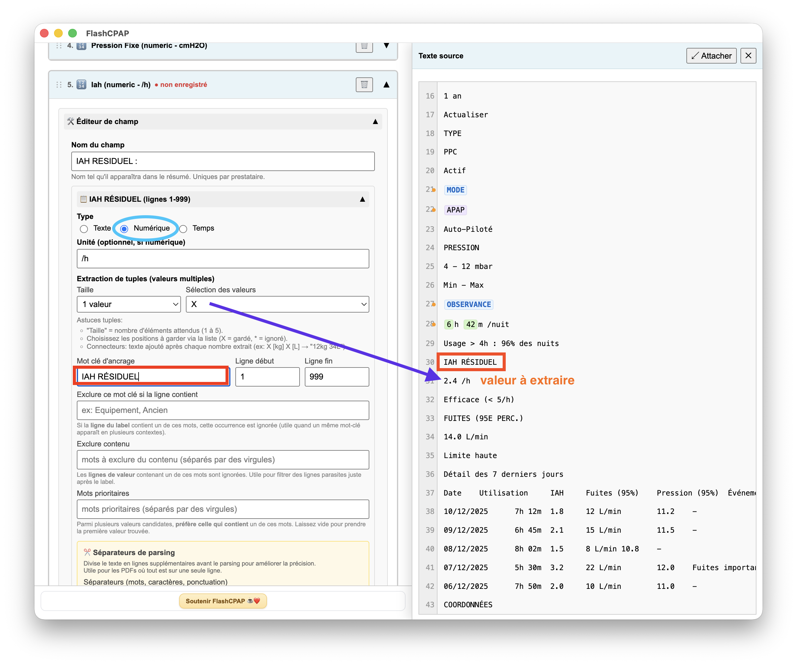 Étape 3C — Configuration du champ Numérique